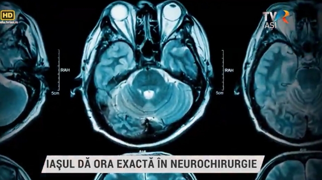 Iașul dă ora exactă în neurochirurgie | VIDEO