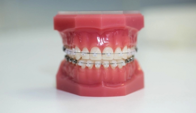 (P) Ortodonția devine prioritate pentru adulți: cererea de aparate dentare moderne crește în marile orașe