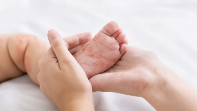 Sănătatea copiilor, la ruleta rusească: Nevaccinarea împotriva rujeolei a dus la reapariția PESS, o boală rară și mortală, în România 