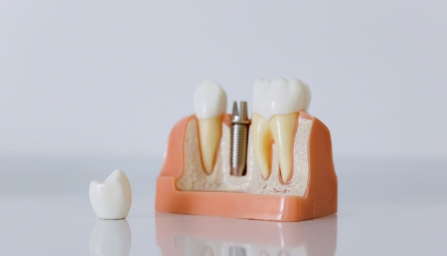 (P) 5 clinici dentare pentru copii în zona Dorobanți